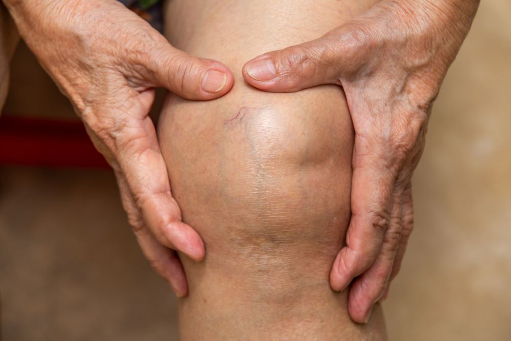 Knee Pain 1000X667