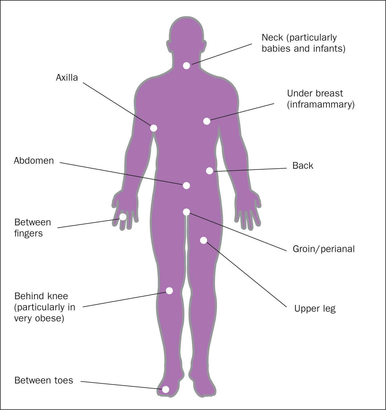 Intertrigo causes, symptoms, diagnosis and intertrigo treatment