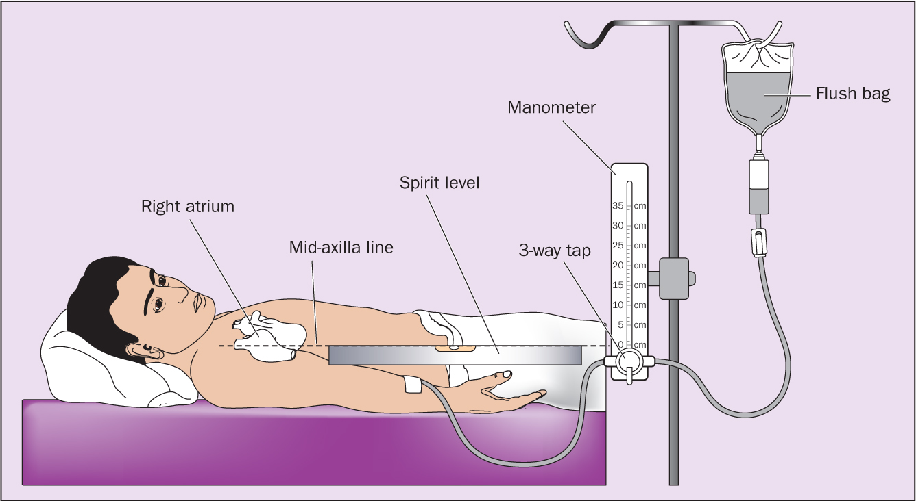 measuring central venous pressure